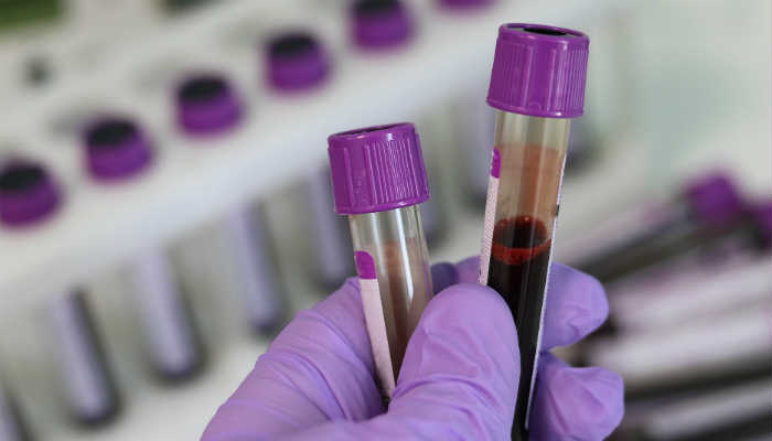 Yunanistan’da aklına esen koronavirüs testi yaptıramayacak